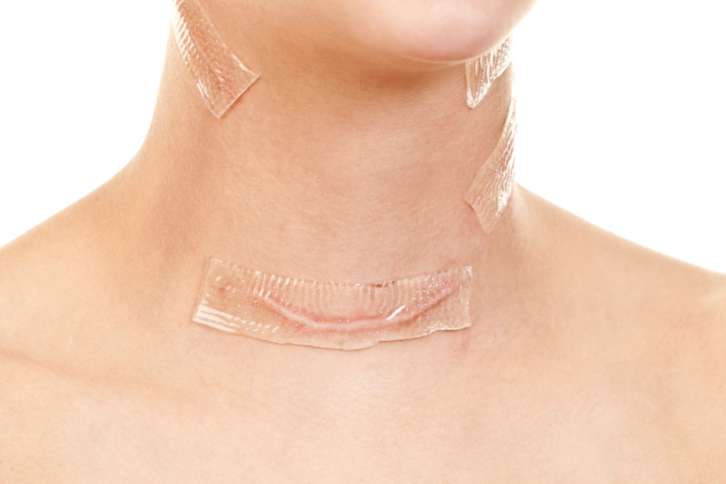 После удаления щитовидки в организме происходят изменения, связанные с недостатком гормонов